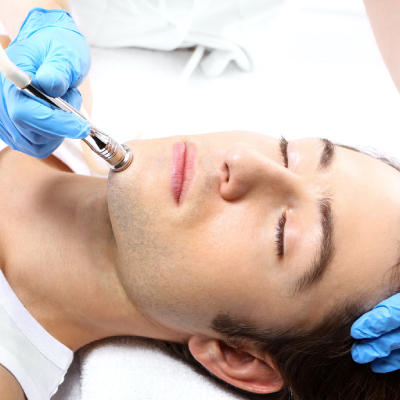 Microdermabrasion facial for Men